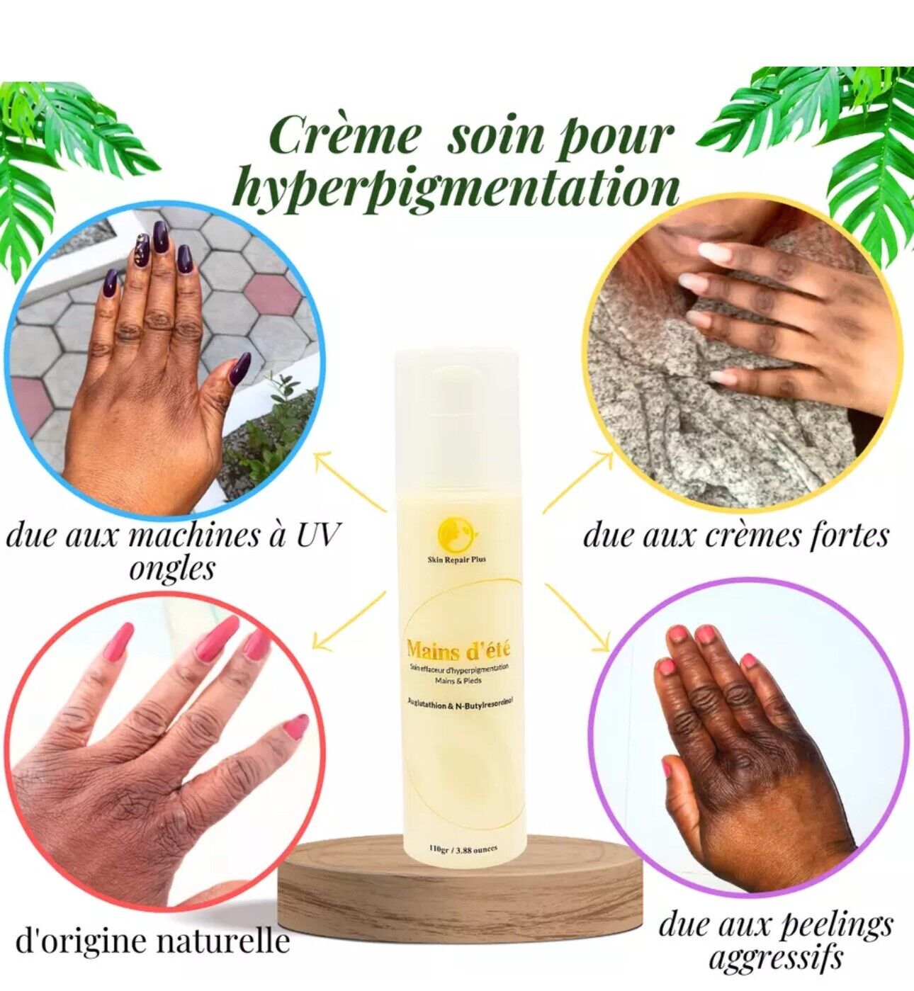 Crème Main Et Pieds Effaceur d'hyperpigmentation pour phalanges, pieds