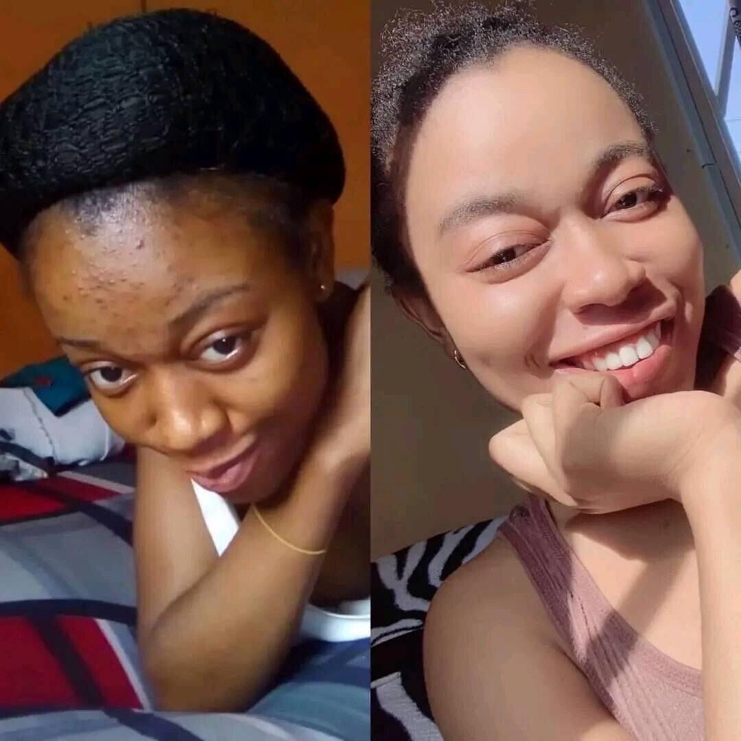 Lotion visage Éclaircissant INTENSE , ANTI Acné, Enlève Les Tâches 60ml - Kyabeauty