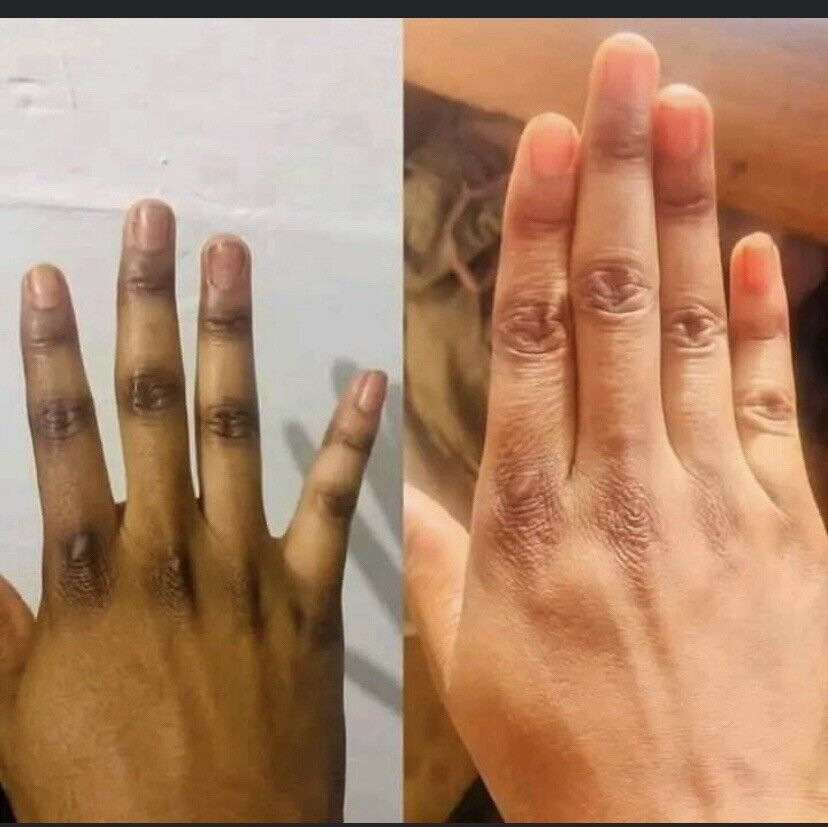 Duo Peau jaune concentré Et Tube blanchissant , pour mains et pieds noirs