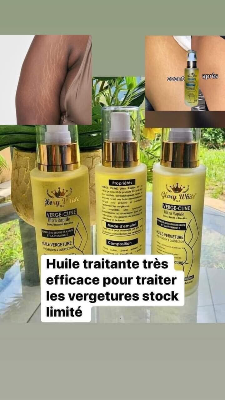 Glory White huile reparatrice antivergetures traitant très efficace - Kyabeauty